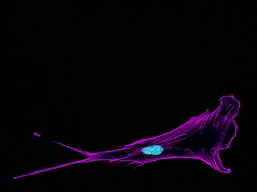 124 - Migration Cellulaire 124 - Migration Cellulaire