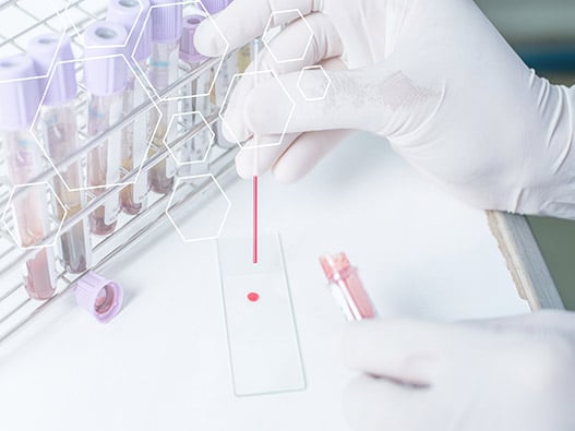 143 -Biobanque 143 -Biobanque