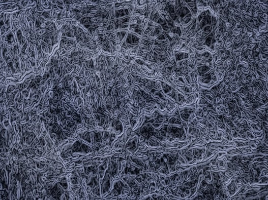 206 - Inhibition-Biofilm 206 - Inhibition-Biofilm