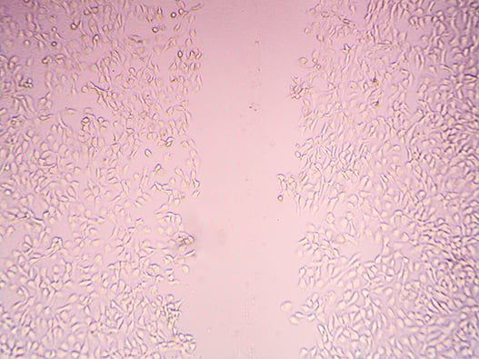 25 - Cell Migration 25 - Cell Migration
