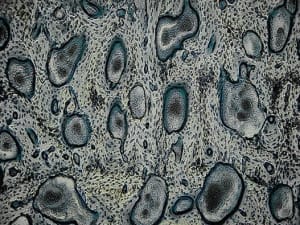 Adipogenesis