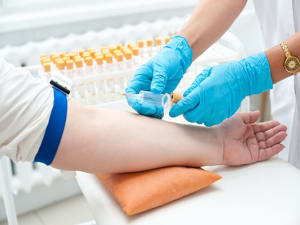 Healthy donors samples