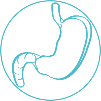 Gastric cancer
