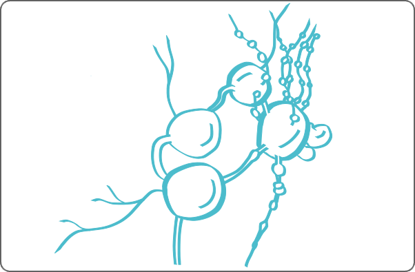 Illustration of lymphoma