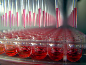 SCREENING 300X225