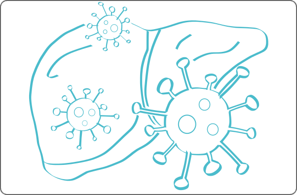 Viral hepatitis illustration