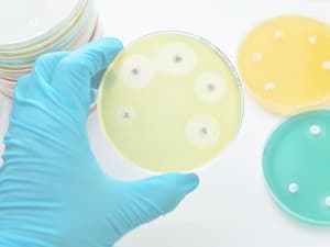 antibiotics 300x225