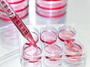 cell culture