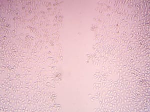 cell migration 300x225