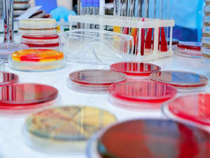 microbio test synergie 300x225