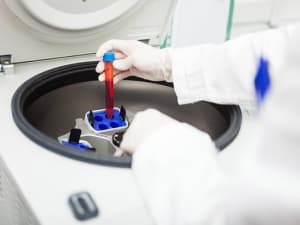 ultracentrifugation 300x225